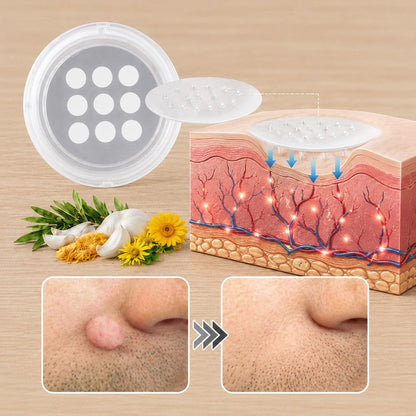 PURESHADE® Maximálně silné náplasti na odstranění bradavic 💧 Cílená péče pro běžné bradavice, plantární bradavice a kožní výrůstky | Jednoduché domácí použití
