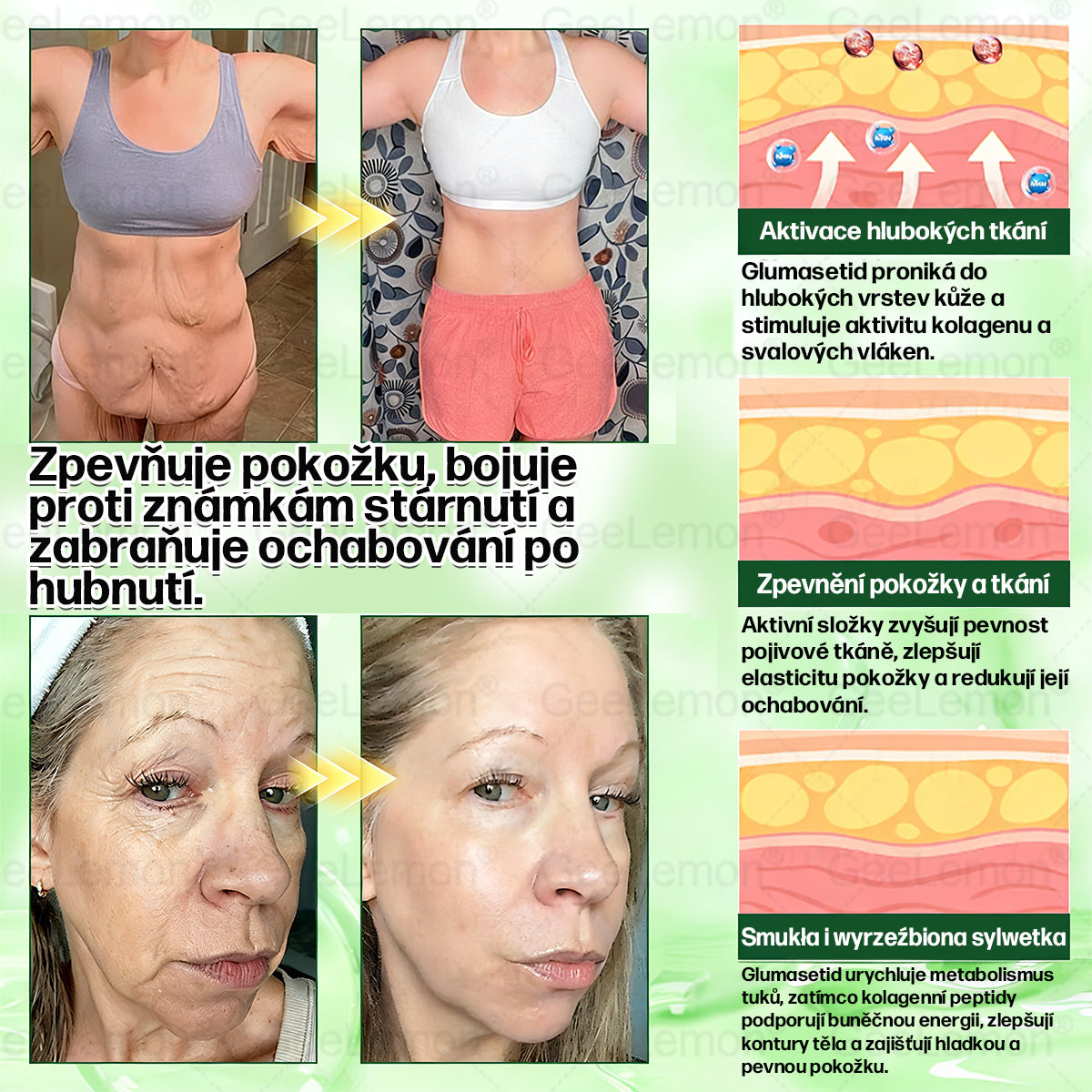 ✅️GeeLemon® 10v1 Nano Mikr jehličková Hubnoucí Náplast 🌿 Berberin + Moringa + NAD+ formule pro přirozenou podporu metabolismu a kontrolu tělesné hmotnosti | Jednoduché použití pouze 1× denně