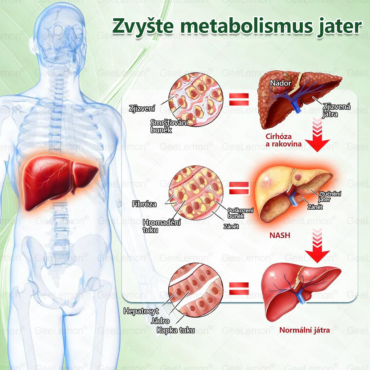 ✅️GeeLemon® 10v1 Nano Mikr jehličková Hubnoucí Náplast 🌿 Berberin + Moringa + NAD+ formule pro přirozenou podporu metabolismu a kontrolu tělesné hmotnosti | Jednoduché použití pouze 1× denně