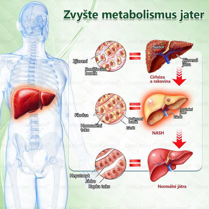 ✅️GeeLemon® 10v1 Nano Mikr jehličková Hubnoucí Náplast 🌿 Berberin + Moringa + NAD+ formule pro přirozenou podporu metabolismu a kontrolu tělesné hmotnosti | Jednoduché použití pouze 1× denně