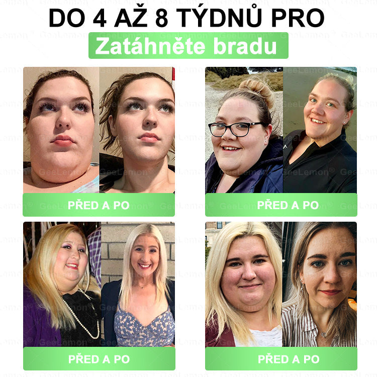 ✅️GeeLemon® 10v1 Nano Mikr jehličková Hubnoucí Náplast 🌿 Berberin + Moringa + NAD+ formule pro přirozenou podporu metabolismu a kontrolu tělesné hmotnosti | Jednoduché použití pouze 1× denně