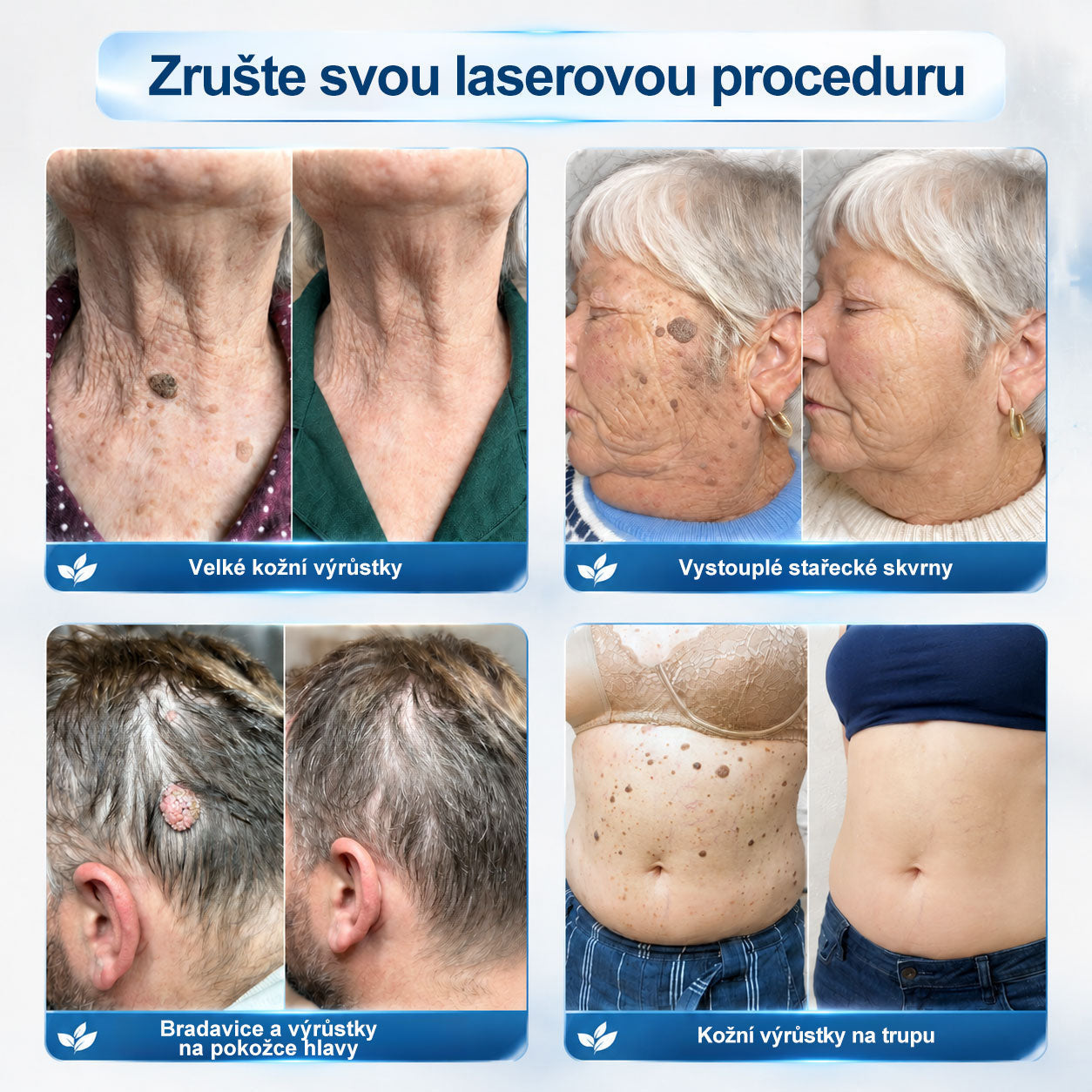 Gratulujeme! Odemkli jste exkluzivní nabídku GeeLemon®! Jako poděkování za vaši objednávku vám dnes nabízíme dodatečnou slevu 40 %. Klikněte níže a využijte tuto speciální nabídku dříve, než vyprší!