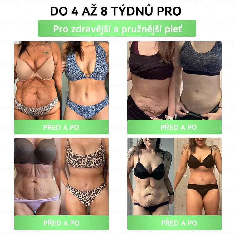 ✅️GeeLemon® 10v1 Nano Mikr jehličková Hubnoucí Náplast 🌿 Berberin + Moringa + NAD+ formule pro přirozenou podporu metabolismu a kontrolu tělesné hmotnosti | Jednoduché použití pouze 1× denně