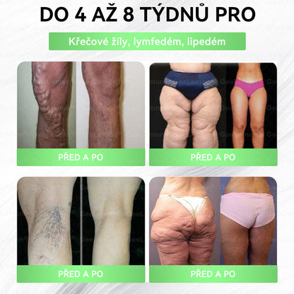 ✅️GeeLemon® 10v1 Nano Mikr jehličková Hubnoucí Náplast 🌿 Berberin + Moringa + NAD+ formule pro přirozenou podporu metabolismu a kontrolu tělesné hmotnosti | Jednoduché použití pouze 1× denně