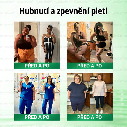 ✅️GeeLemon® 10v1 Nano Mikr jehličková Hubnoucí Náplast 🌿 Berberin + Moringa + NAD+ formule pro přirozenou podporu metabolismu a kontrolu tělesné hmotnosti | Jednoduché použití pouze 1× denně