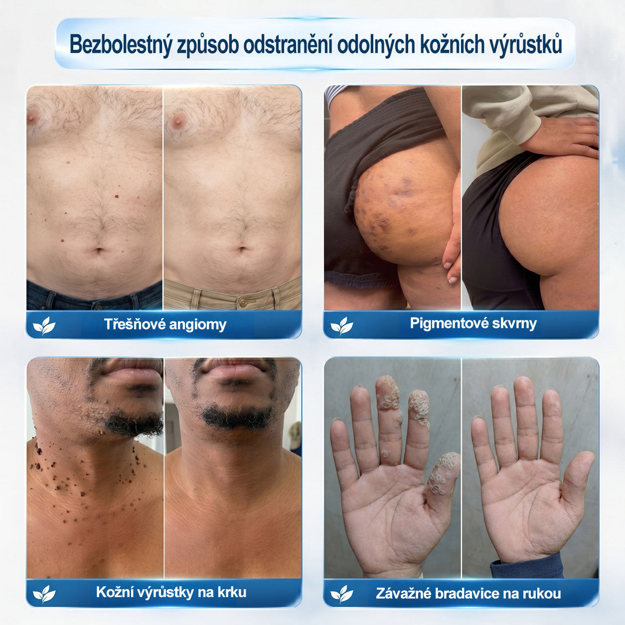 Gratulujeme! Odemkli jste exkluzivní nabídku GeeLemon®! Jako poděkování za vaši objednávku vám dnes nabízíme dodatečnou slevu 40 %. Klikněte níže a využijte tuto speciální nabídku dříve, než vyprší!