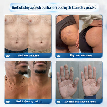 Gratulujeme! Odemkli jste exkluzivní nabídku GeeLemon®! Jako poděkování za vaši objednávku vám dnes nabízíme dodatečnou slevu 40 %. Klikněte níže a využijte tuto speciální nabídku dříve, než vyprší!