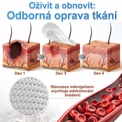 PURESHADE® Maximálně silné náplasti na odstranění bradavic 💧 Cílená péče pro běžné bradavice, plantární bradavice a kožní výrůstky | Jednoduché domácí použití