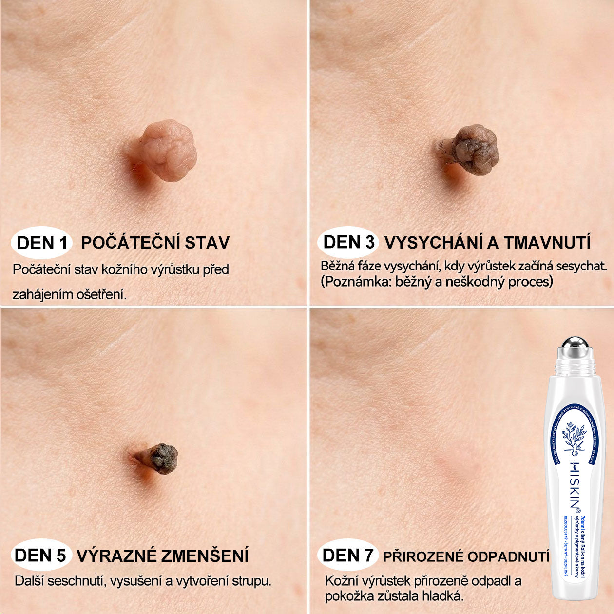 Gratulujeme! Odemkli jste exkluzivní nabídku GeeLemon®! Jako poděkování za vaši objednávku vám dnes nabízíme dodatečnou slevu 40 %. Klikněte níže a využijte tuto speciální nabídku dříve, než vyprší!