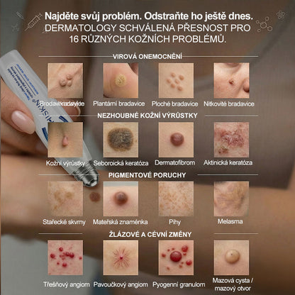 Gratulujeme! Odemkli jste exkluzivní nabídku GeeLemon®! Jako poděkování za vaši objednávku vám dnes nabízíme dodatečnou slevu 40 %. Klikněte níže a využijte tuto speciální nabídku dříve, než vyprší!