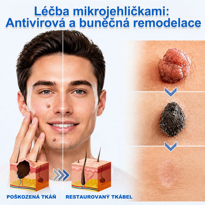 PURESHADE® Maximálně silné náplasti na odstranění bradavic 💧 Cílená péče pro běžné bradavice, plantární bradavice a kožní výrůstky | Jednoduché domácí použití