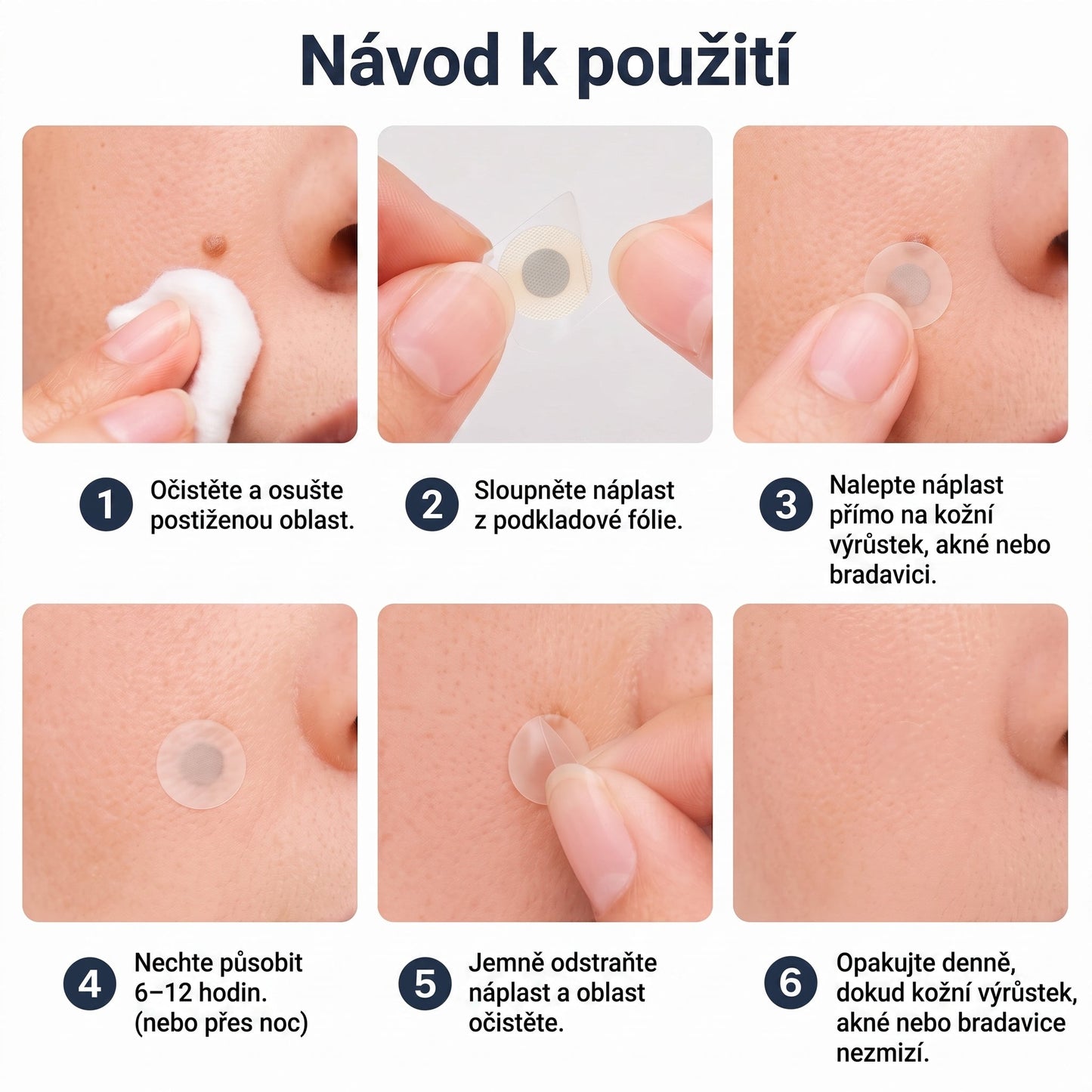 PURESHADE® Maximálně silné náplasti na odstranění bradavic 💧 Cílená péče pro běžné bradavice, plantární bradavice a kožní výrůstky | Jednoduché domácí použití